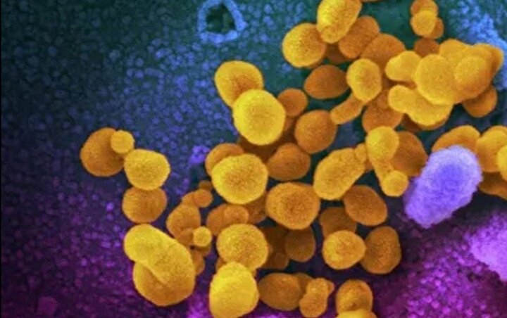 фото вируса