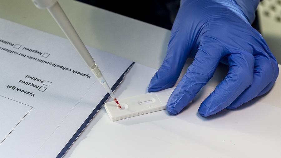 Проведение теста на наличие антител к коронавирусу в Чехии                                                           Фото: ТАСС/Zuma