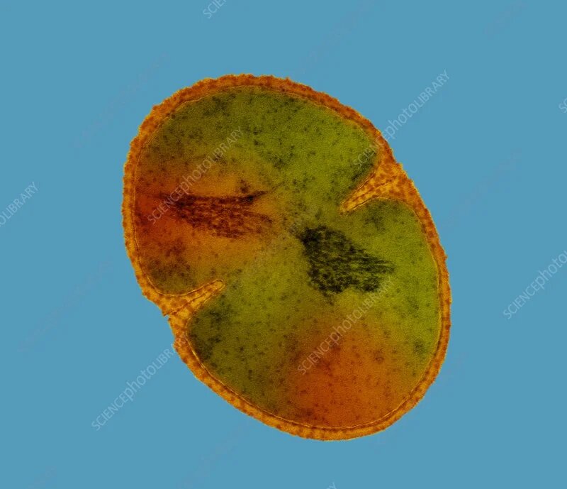Бактерия Staphylococcus hominis, фото sciencephoto.com
