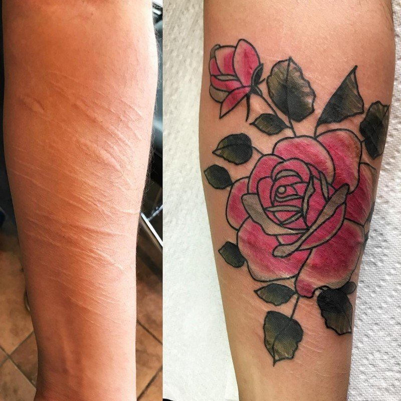 Татуировки на шрамах на руке: красота и символика