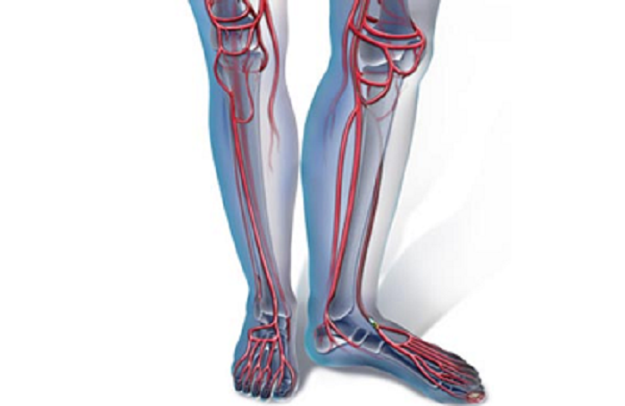 сестринская помощь при заболеваниях сосудов. нарушение кровоснабжения конечностей.