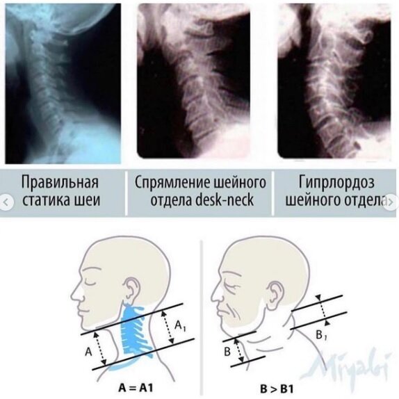 Особенности зоны шеи и декольте