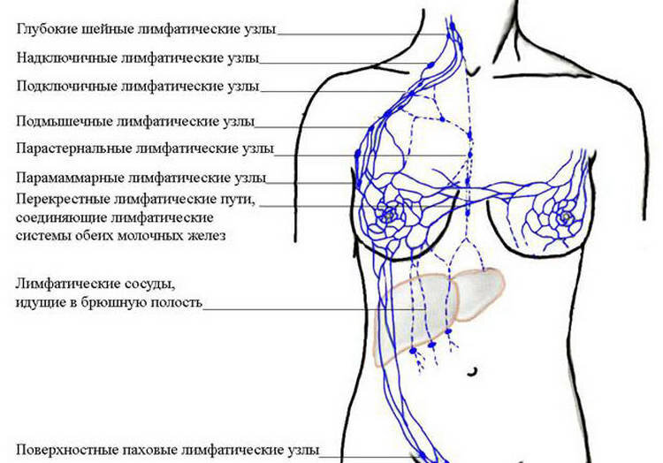 Аксиллярный лимфоузел молочной железы что это такое