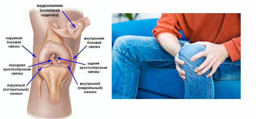 Болит левое колено причина. Боль под коленной чашечкой. Болит колено под чашечкой. Боль под чашечкой в коленном суставе. Боль под чашечкой колена.
