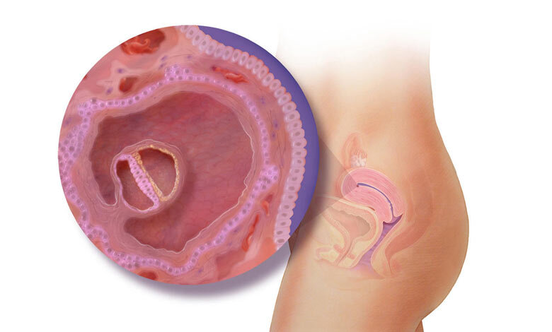 Так выглядит эмбрион на 4-ой неделе