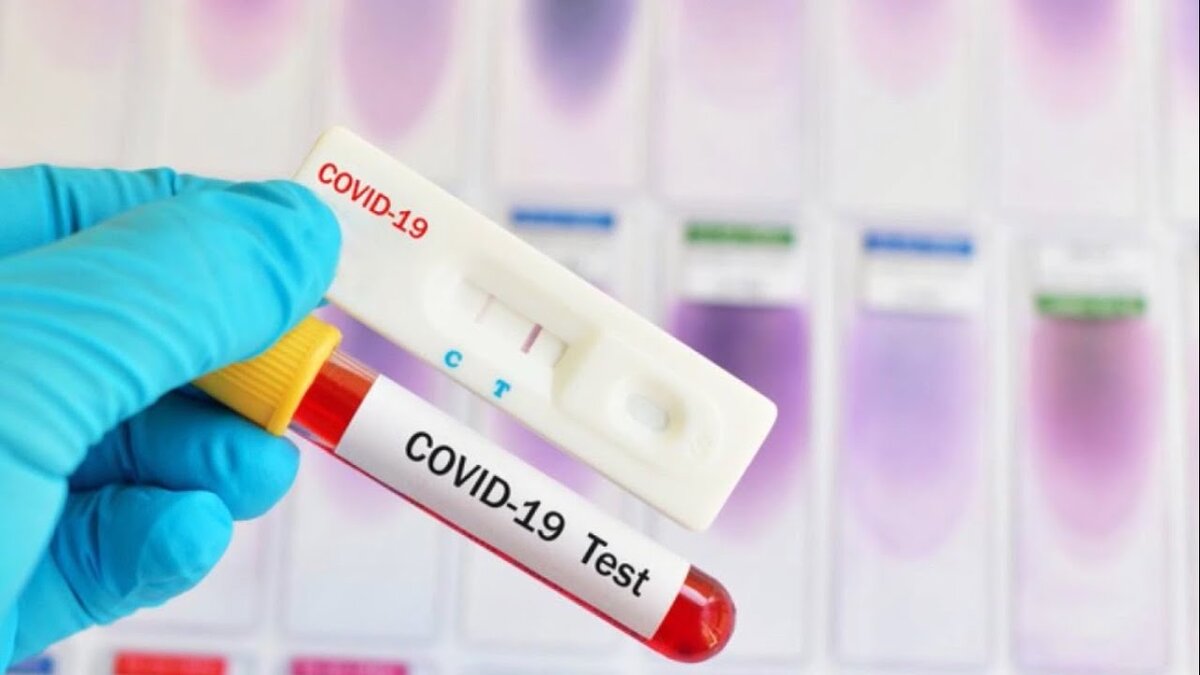 Оспорить тест на коронавирус