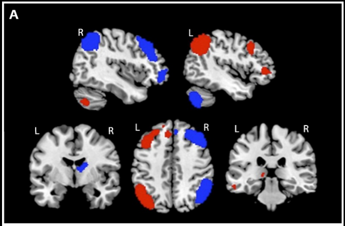 functional MRI during executive control tasks