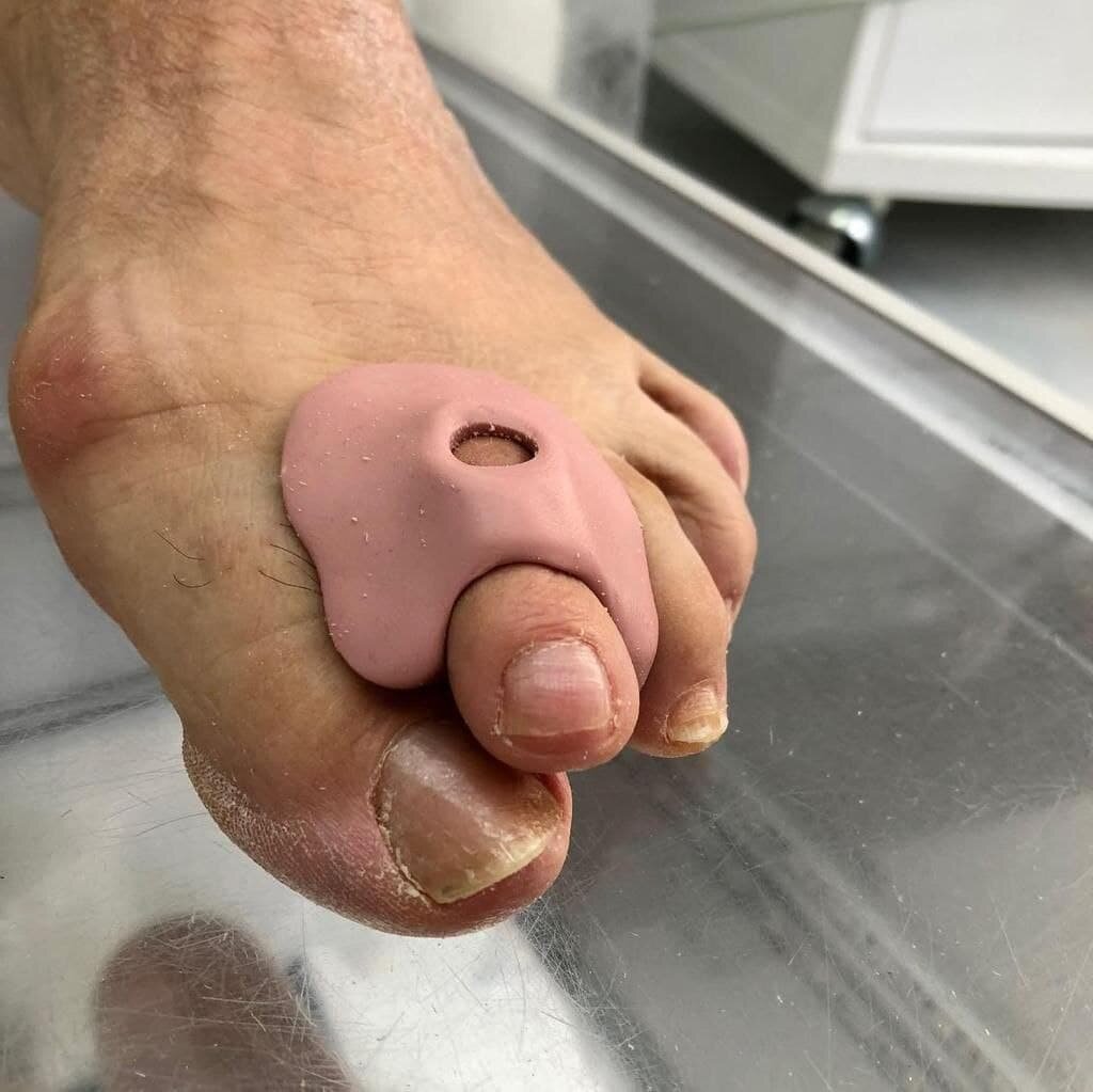 Разгрузочный ортез