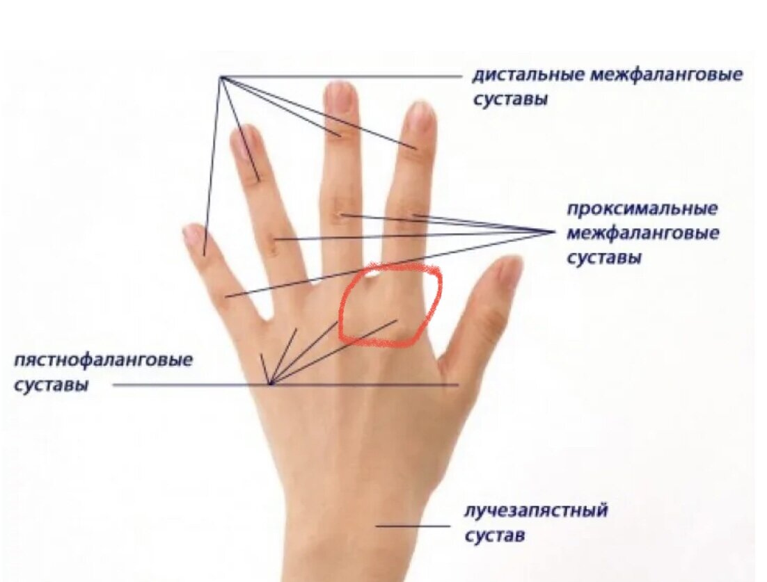 Проксимальные межфаланговые суставы кисти