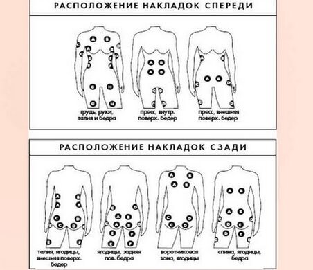 Расположение накладок при миостимуляция живота