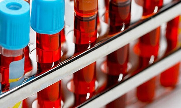 Пробирки с кровьюOg.ru
На первой стадии препарат показал себя безопасным, он переносится без осложнений. Компания ожидает, что финальная стадия клинических испытаний начнется в июле.
