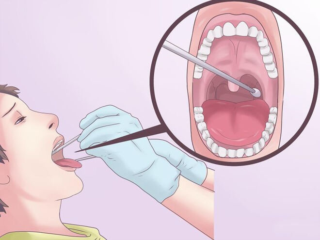 Мазок из ротоглотки