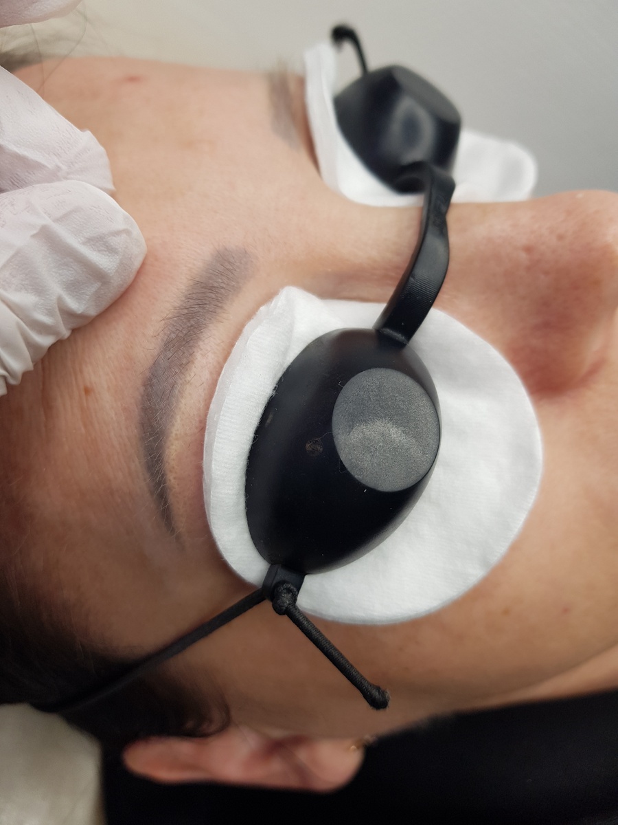 Перманентный макияж до процедуры лазерного удаления. 