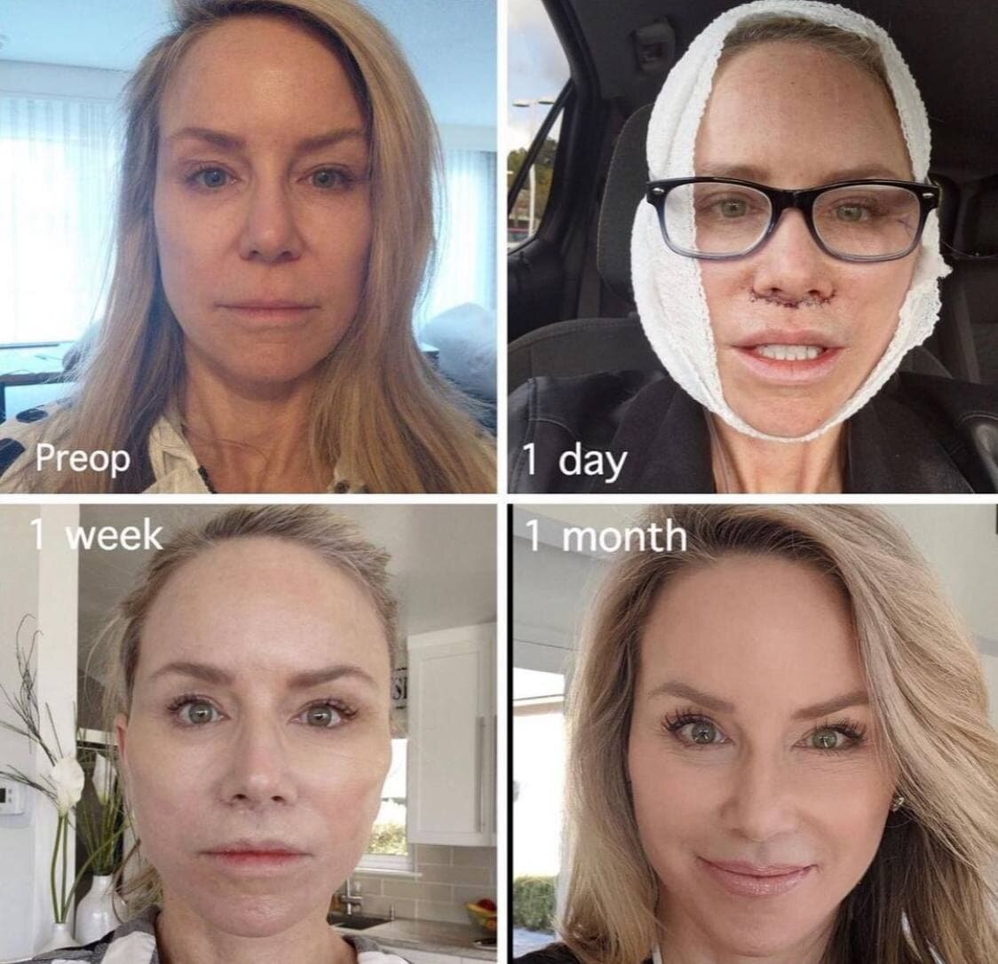 Результат пластической операции.