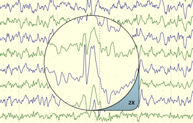 Searching epileptiform EEG activity