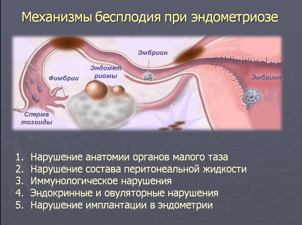 Клиническая картина бесплодия