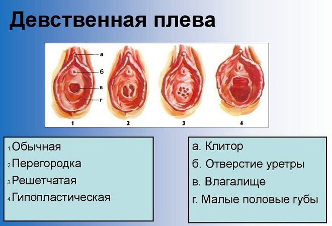 Дефлорация — Википедия