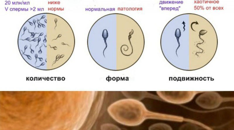 Значение подвижности сперматозоидов в спермограмме