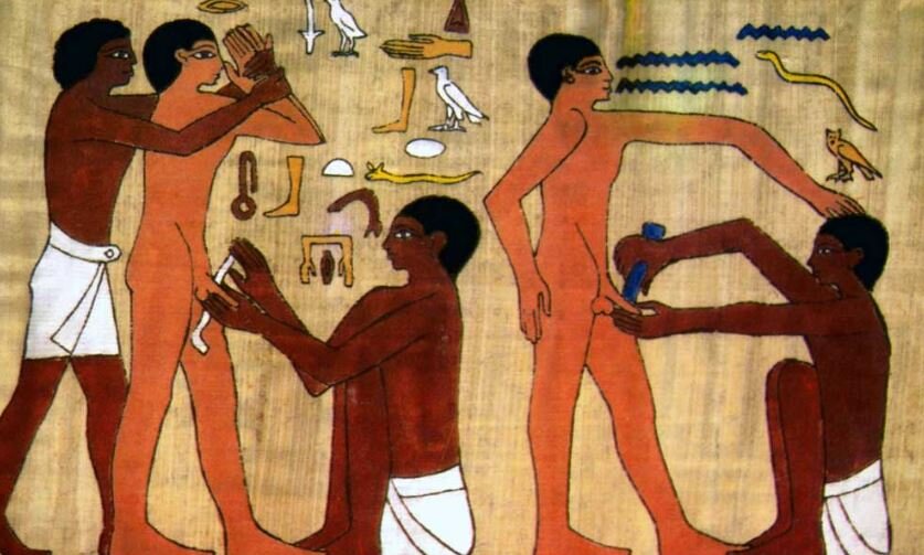 Обрезание: режущая правда с историей, обрядами и религией 