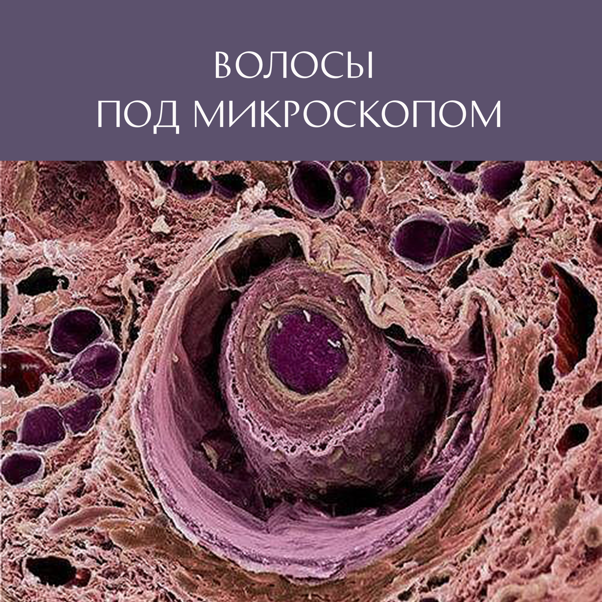 Как выглядит человеческий волос под микроскопом