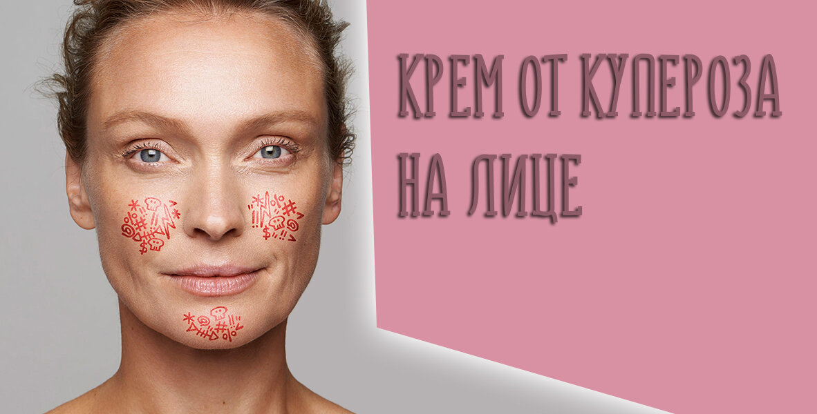 Что такое купероз и как с ним бороться?