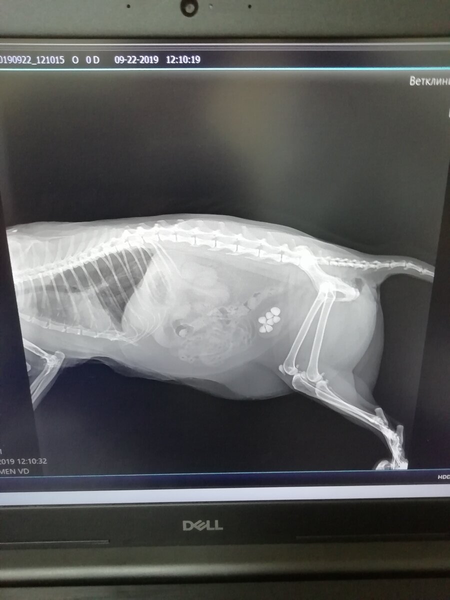 Камни в мочевом пузыре.