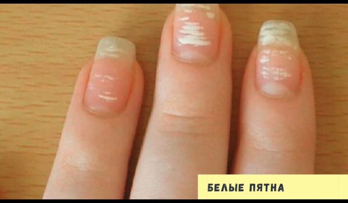 Белые пятна