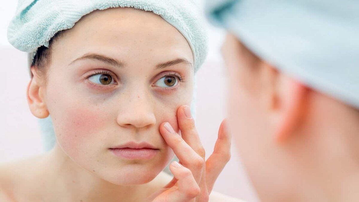 Взято на doctor-glaz.