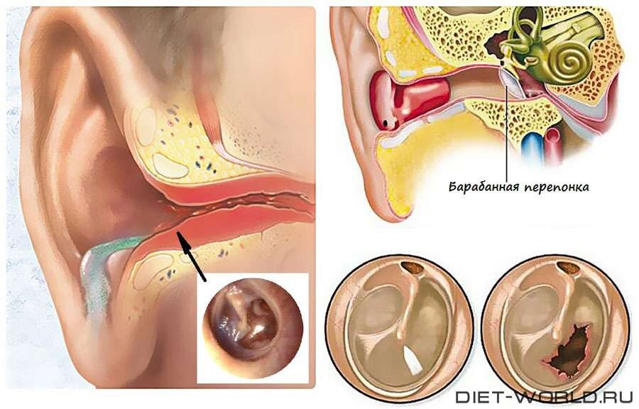 Боль в ухе - причины, симптомы и диагностика, показания для обращения к врачу