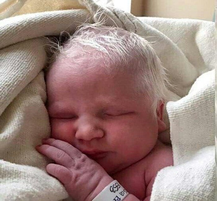 Могут ли дети родиться с волосами. Новорождённые дети с волосами. Нлвлпожденве дети с волосами. Новорожденный ЧС волосами. Новорожденный с белыми волосами.