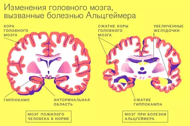 Картинка взята для иллюстрации из свободного источника