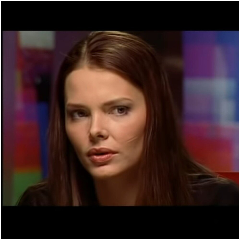 елизавета боярская. лиза боярская шрамы на лице. шрам на лице у боярской. лиза боярская шрам на щеке. знаменитости с дефектами внешности.