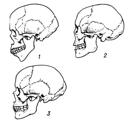 Строение черепа у различных рас.                1 - Монголиоидная. 2 - европеоидная. 3 - Негроидная. 