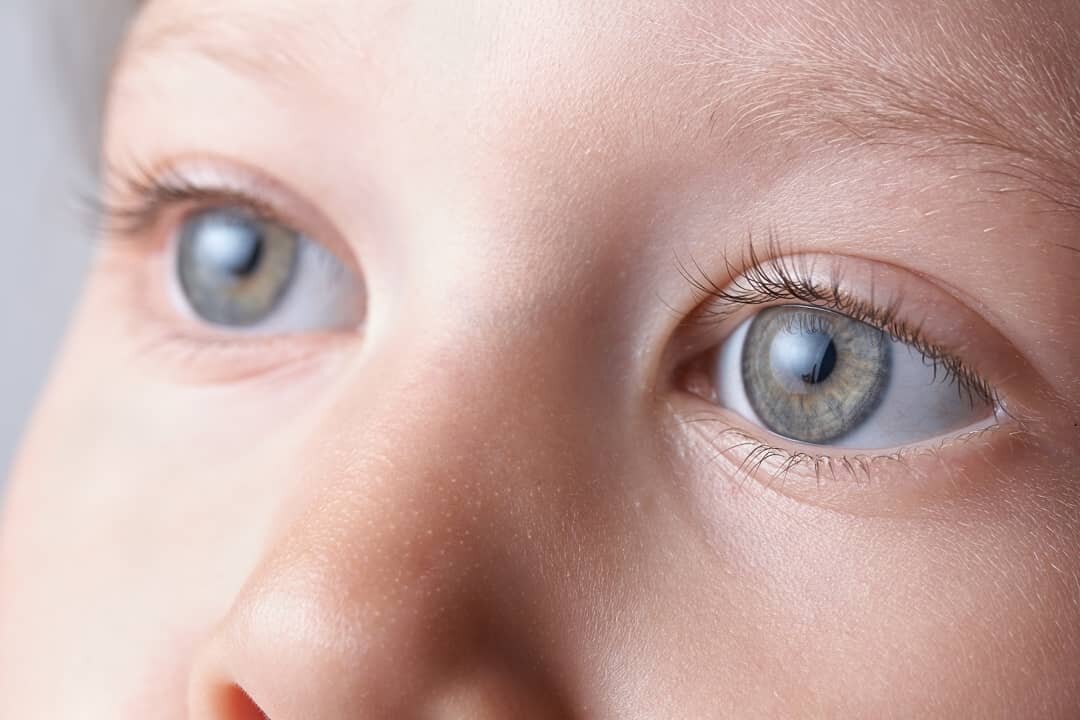 Какие глазные капли можно использовать при катаракте