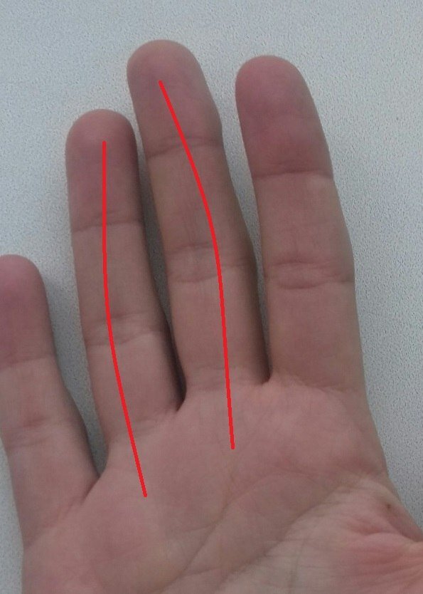Хиромантия по руке мезинец. Мозоль на среднем пальце правой руки. Линия на правом мизинце. Пальцы в хиромантии