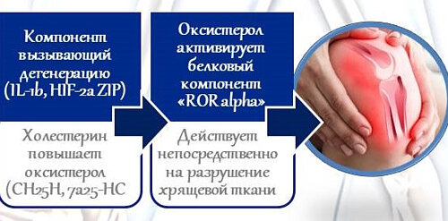 Приток холестерина в дегенеративный хрящ за счет ряда процессов вызывает его разрушение и артрит