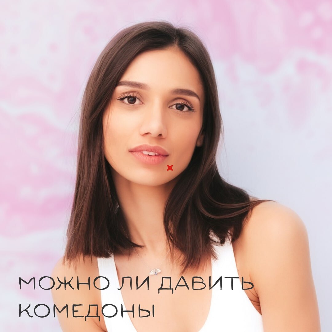 Можно ли давить комедоны | Косметология "БьютиНега" | Дзен