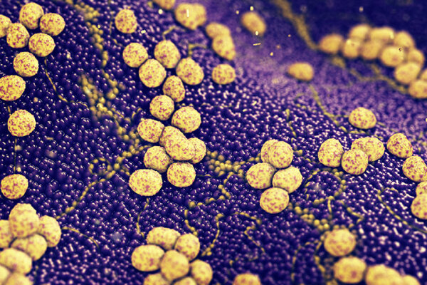 Micrococcus sedentarius 