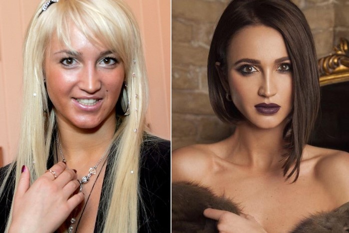 Ольга до и после пластических операций 