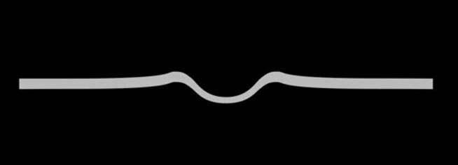 Вмя­ти­на на выпук­лой или сла­бо выпук­лой поверх­но­сти может иметь воз­вы­шен­но­сти по её краю.