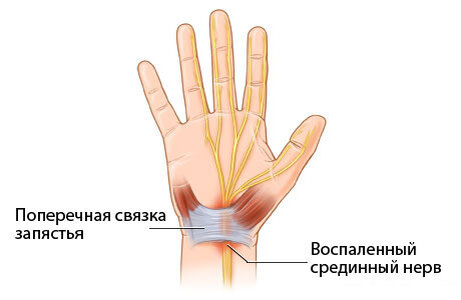 Источник: Интернет