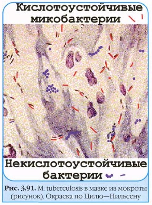 Как нарисовать снеговика: 14 классных вариантов - Лайфхакер