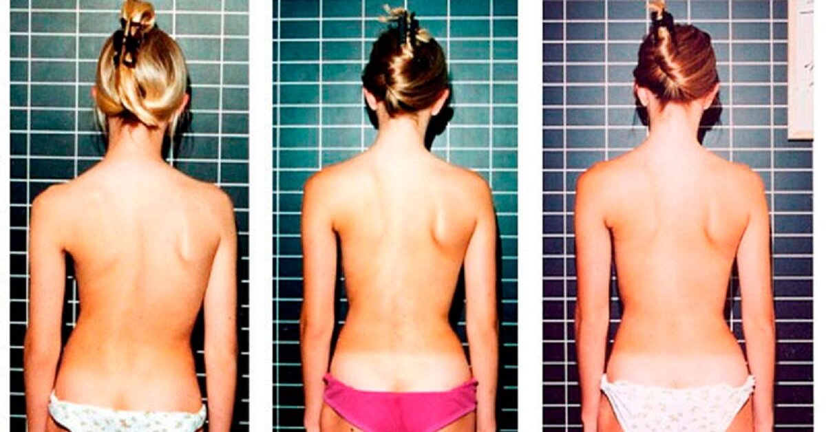 Чем раньше раньше обнаружите, тем больше шанс на полное выздоровление