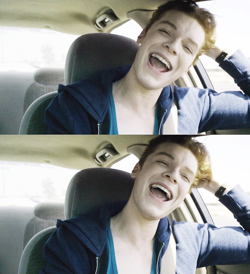 ©SHAMELESS ian gallager bipolar