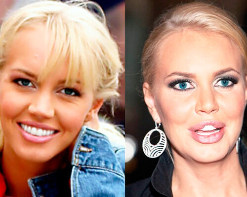 Маша Малиновская до и после пластики.