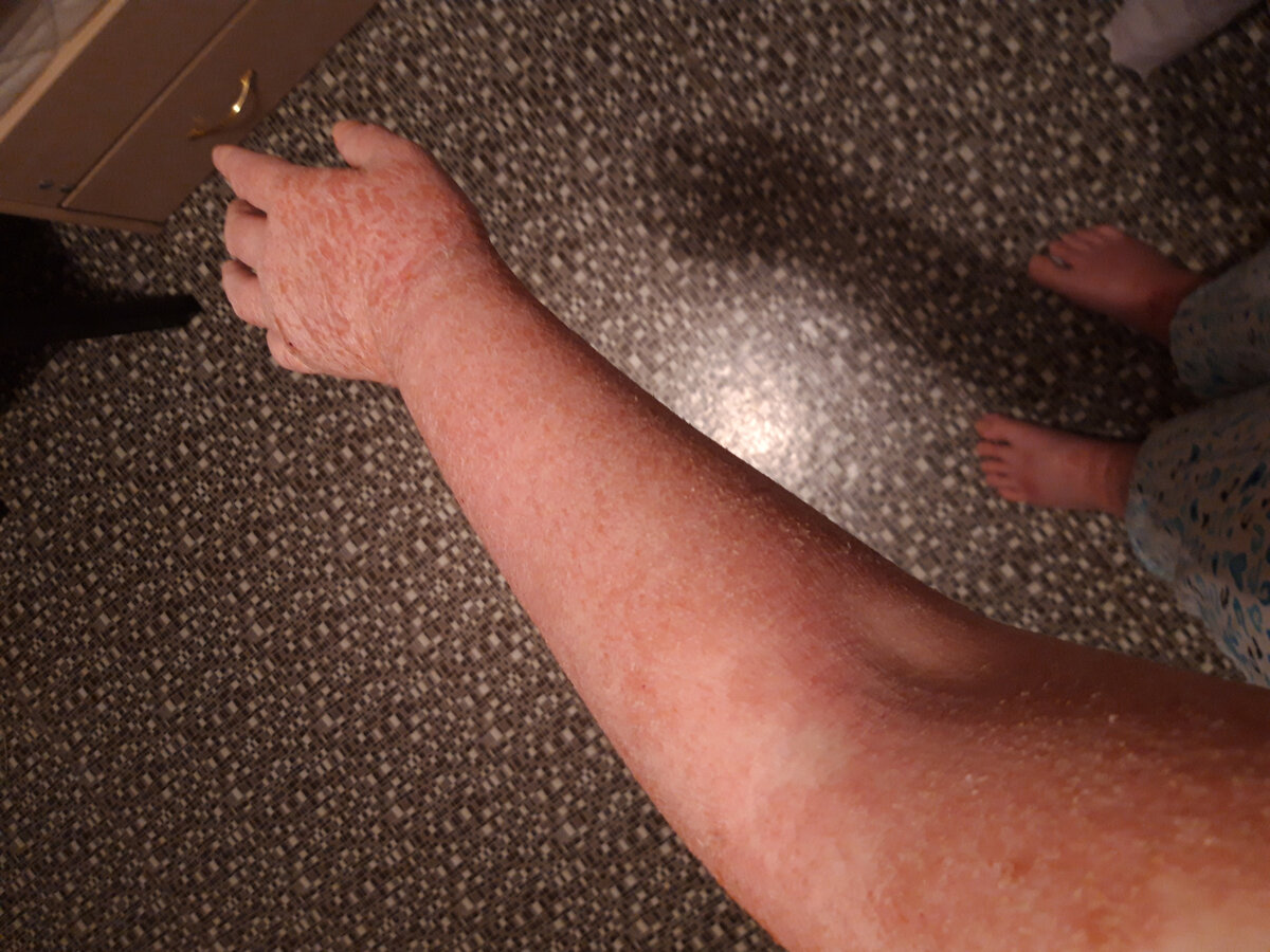 Внешняя сторона моей левой руки и верх стоп