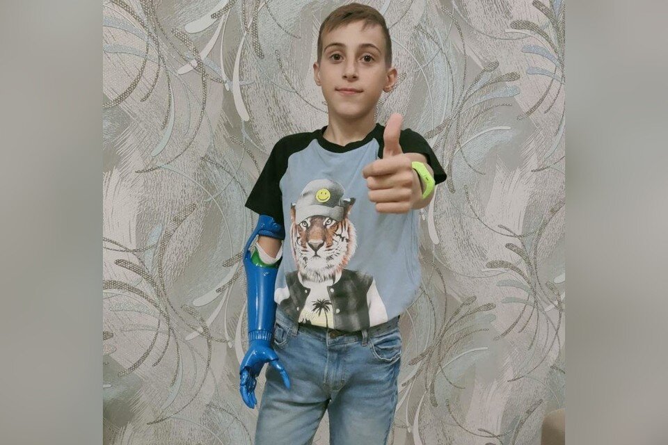 Протез помогает Вове не только в бытовых делах, но и в учебе Фото: Светлана Б.