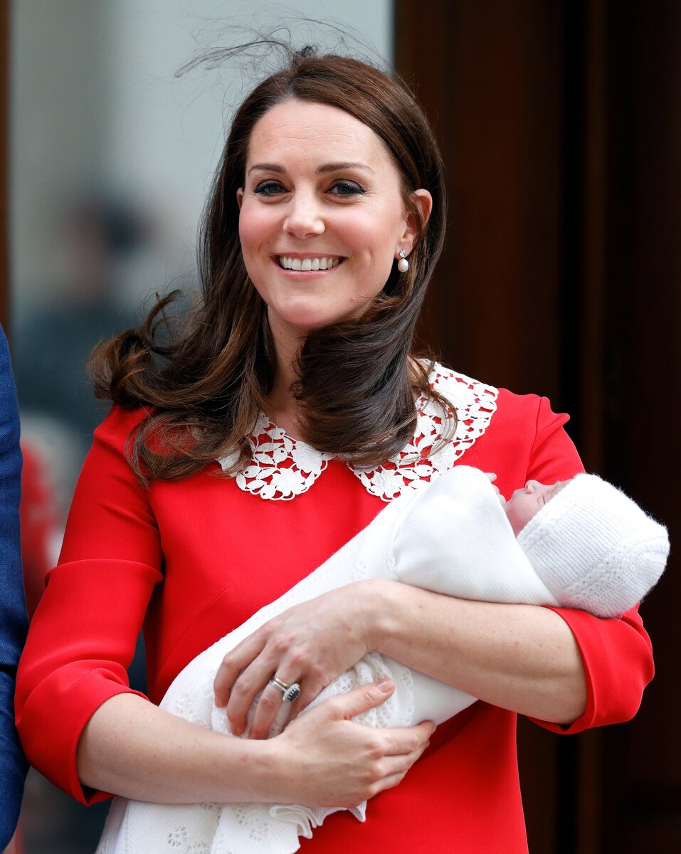 Принц уильям и кейт миддлтон. Кейт миддлтон 2022. Кейт миддлтон виниры. Фото миддлтон после операции. Пластические операции кейт мидлтон.