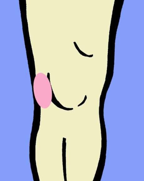 5 основных причин, почему болят колени