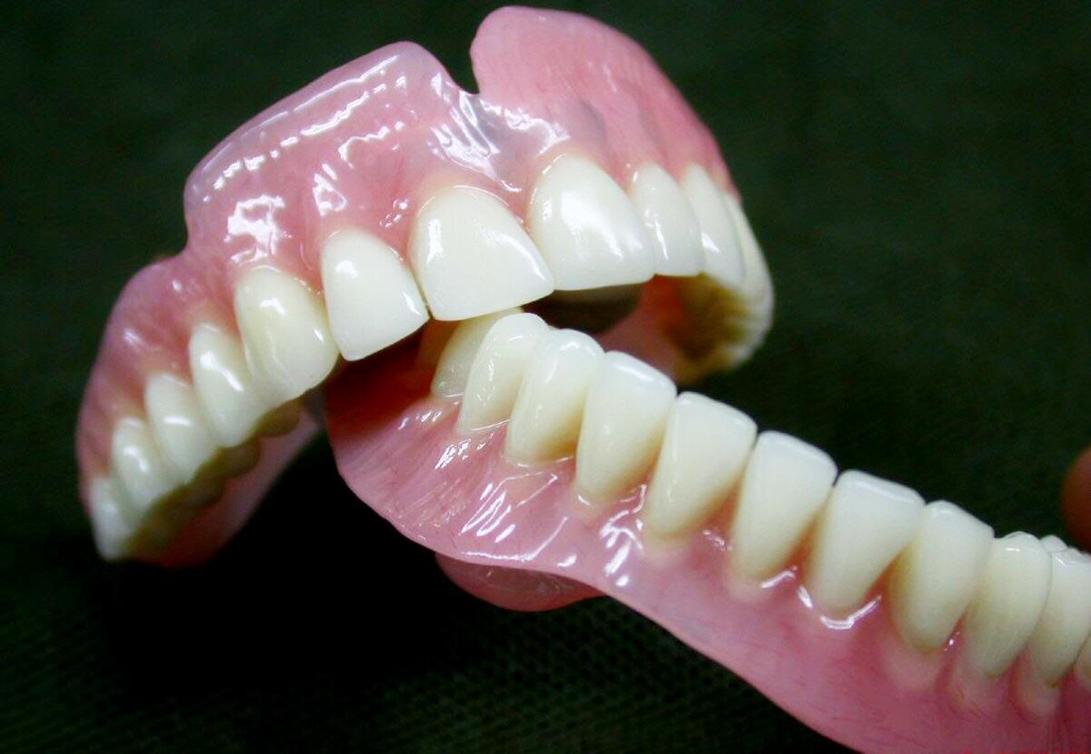 Стоматологическое протезирование отзывы. Пластмассовые зубные протезы. Пластмассовый съемный протез. Полный съемный пластмассовый протез. Зубные протезы из пластмассы.